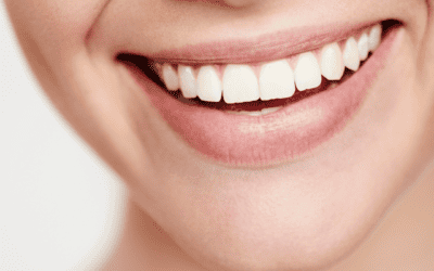 Replacing Missing Teeth and Restoring Your Smile