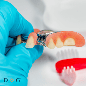 Partial Denture